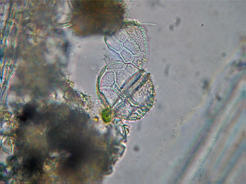 Dinoflagellato ?